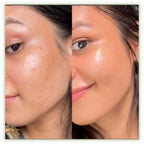 ✨ARENCIA- VITAMINA C Y GLUTATION PARA UNA PIEL SIN MANCHAS DESDE LA PRIMERA APLICACION✨
