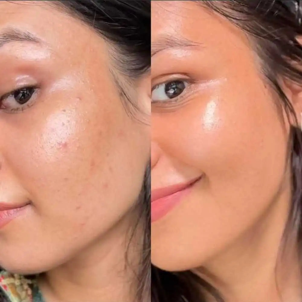 ARENCIA El secreto del skincare coreano para una piel radiante