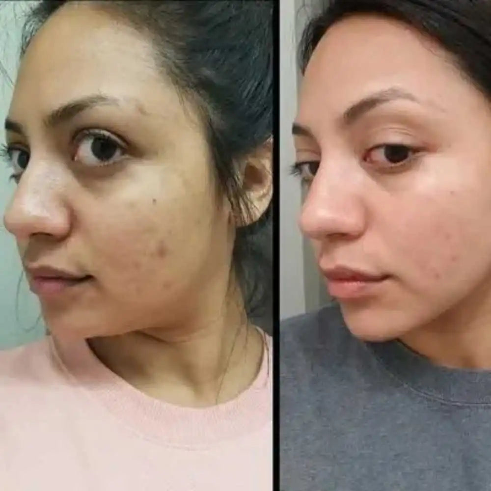 ARENCIA El secreto del skincare coreano para una piel radiante